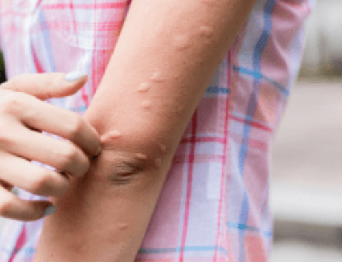 拒絕化學驅蚊！5種防蚊方法讓你擺脫蚊子困擾！